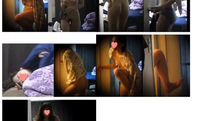 Die schöne Halbmodel hat eine helle Haut, auf der sich grobe Haare abzeichnen.
