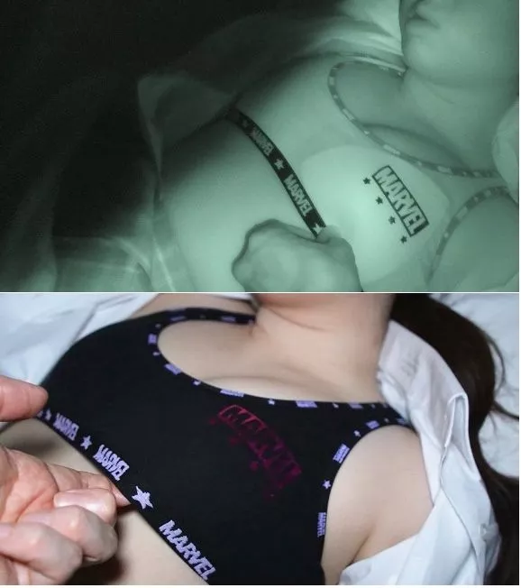 2-B　광영 사토（가명）