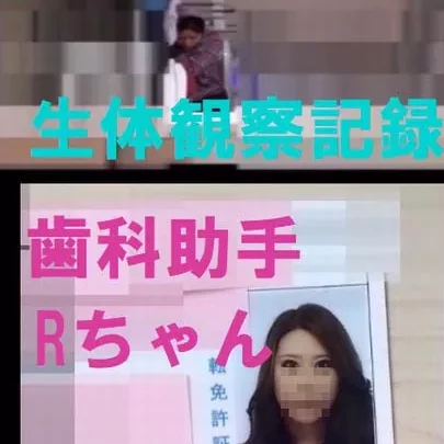歯科助手ちゃんの覗き見観察01